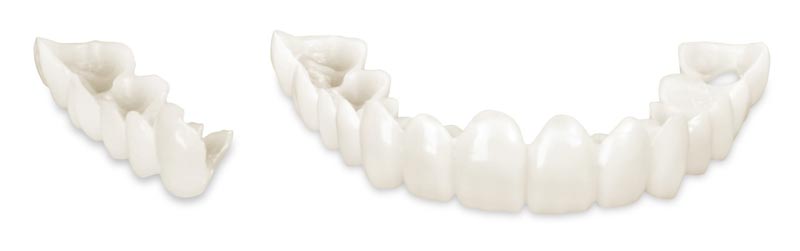 Snap-On Smile Work in Santa Barbara, CA